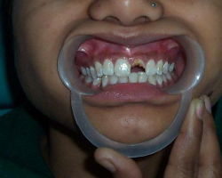 dental10