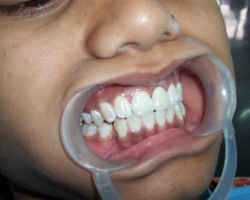 dental11