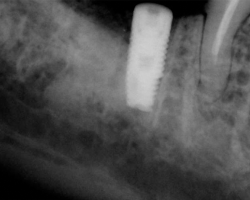 dental12