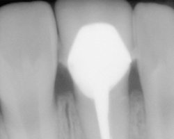 dental9
